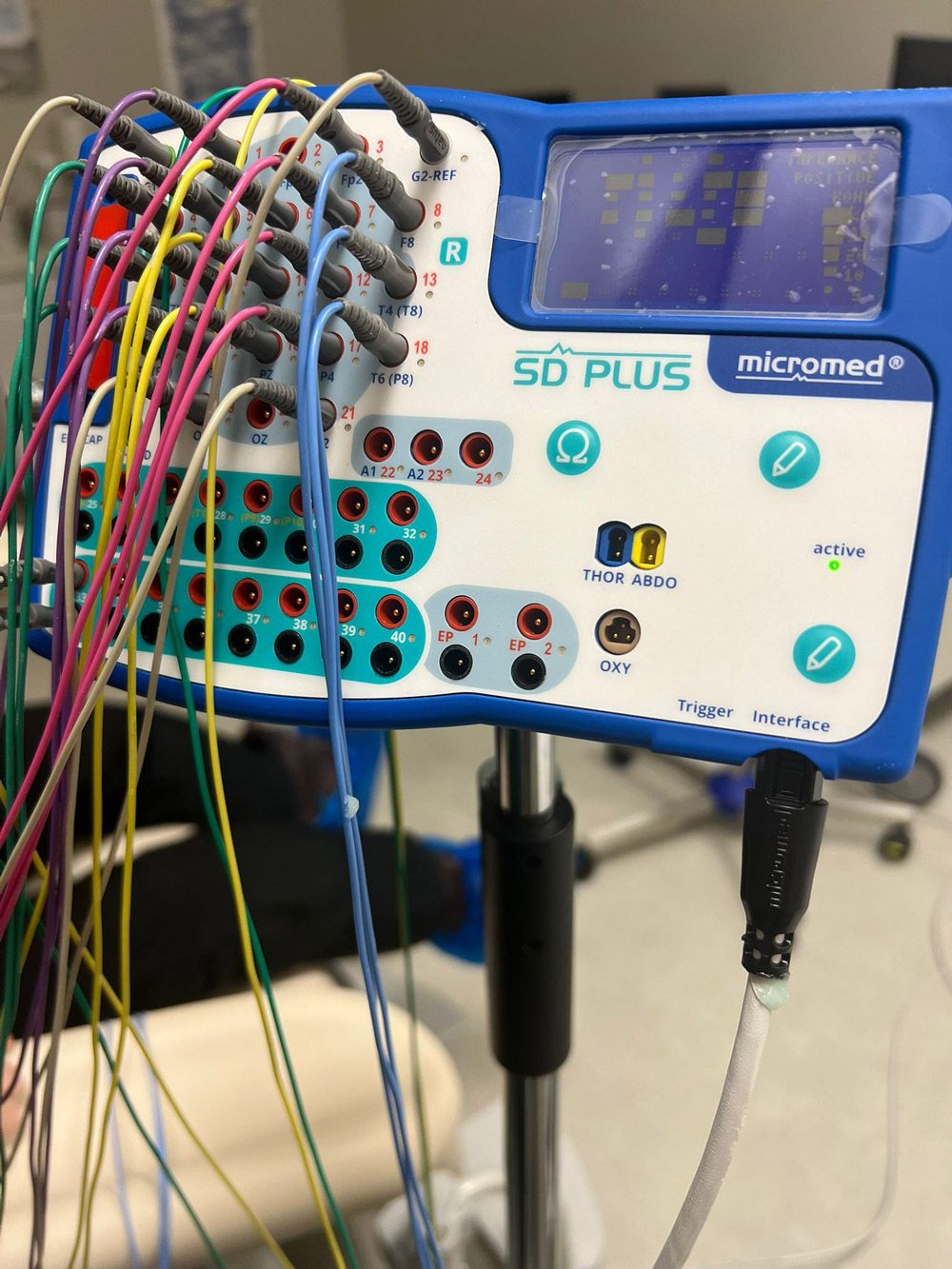 Elektroencefalogramma-neiromed-astra-neiroklinika