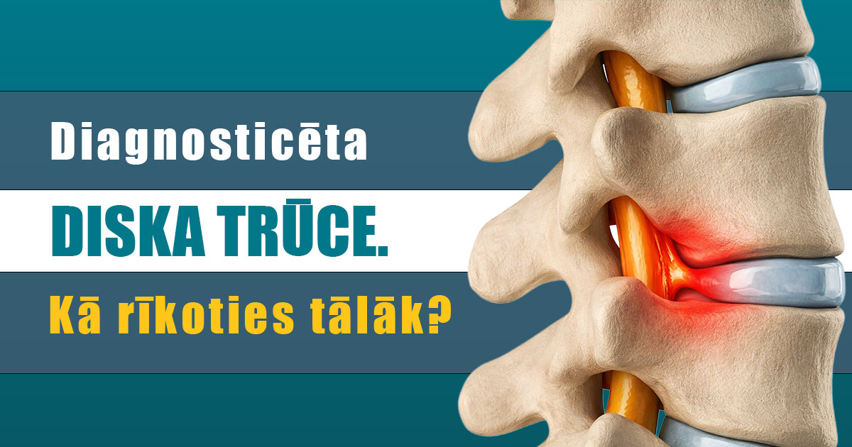 Diagnosticēta diska trūce. Kā rīkoties tālāk