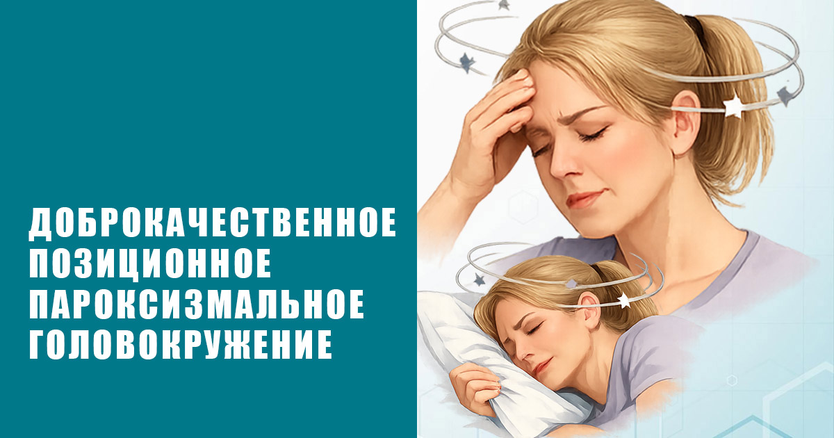 Доброкачественное позиционное пароксизмальное головокружение
