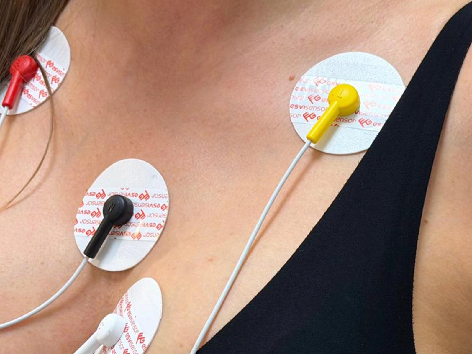 EKG Holtera monitorēšana (24–168 h) neiromed ASTRA
